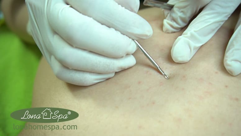 sản phẩm chăm sóc hỗ trợ giảm mụn Botani