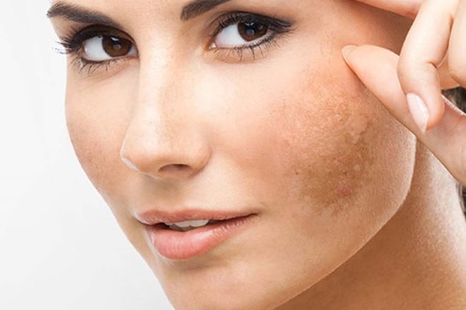 bộ chăm sóc giảm nám và đốm sắc tố Obagi
