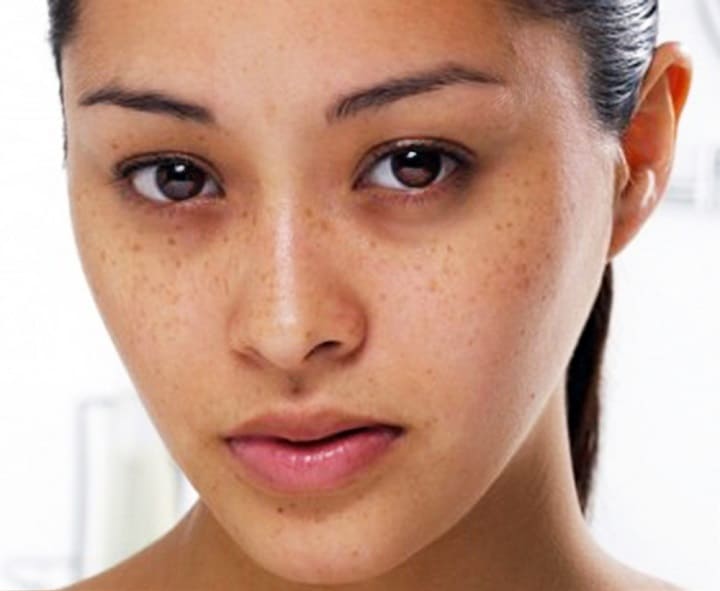 kem dưỡng da giảm nám và đốm sắc tố Obagi