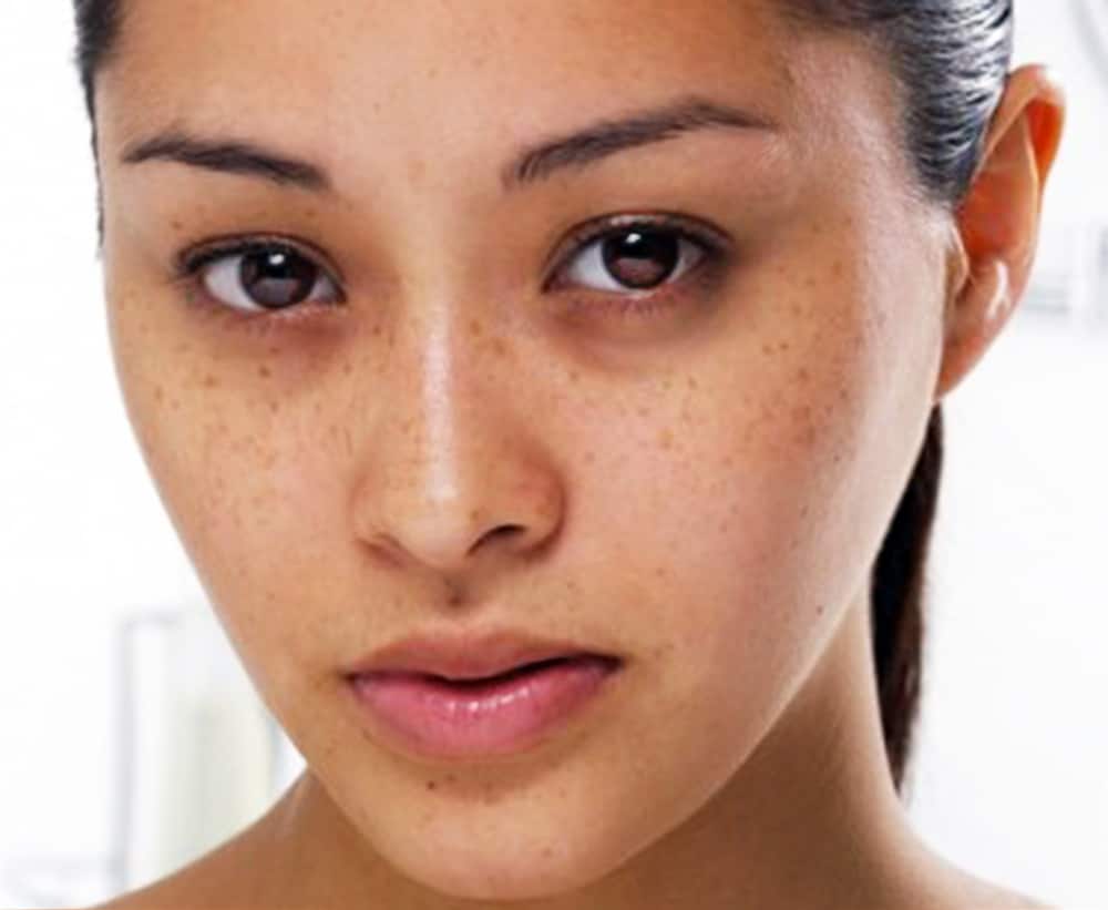 Kem dưỡng da trị nám ban đêm ObagiC Rx CTherapy chính hãng