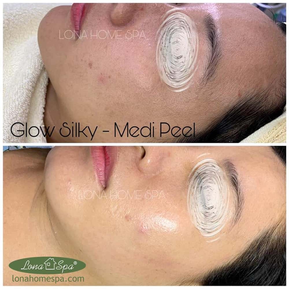 gel chăm sóc da làm sáng và đều màu da