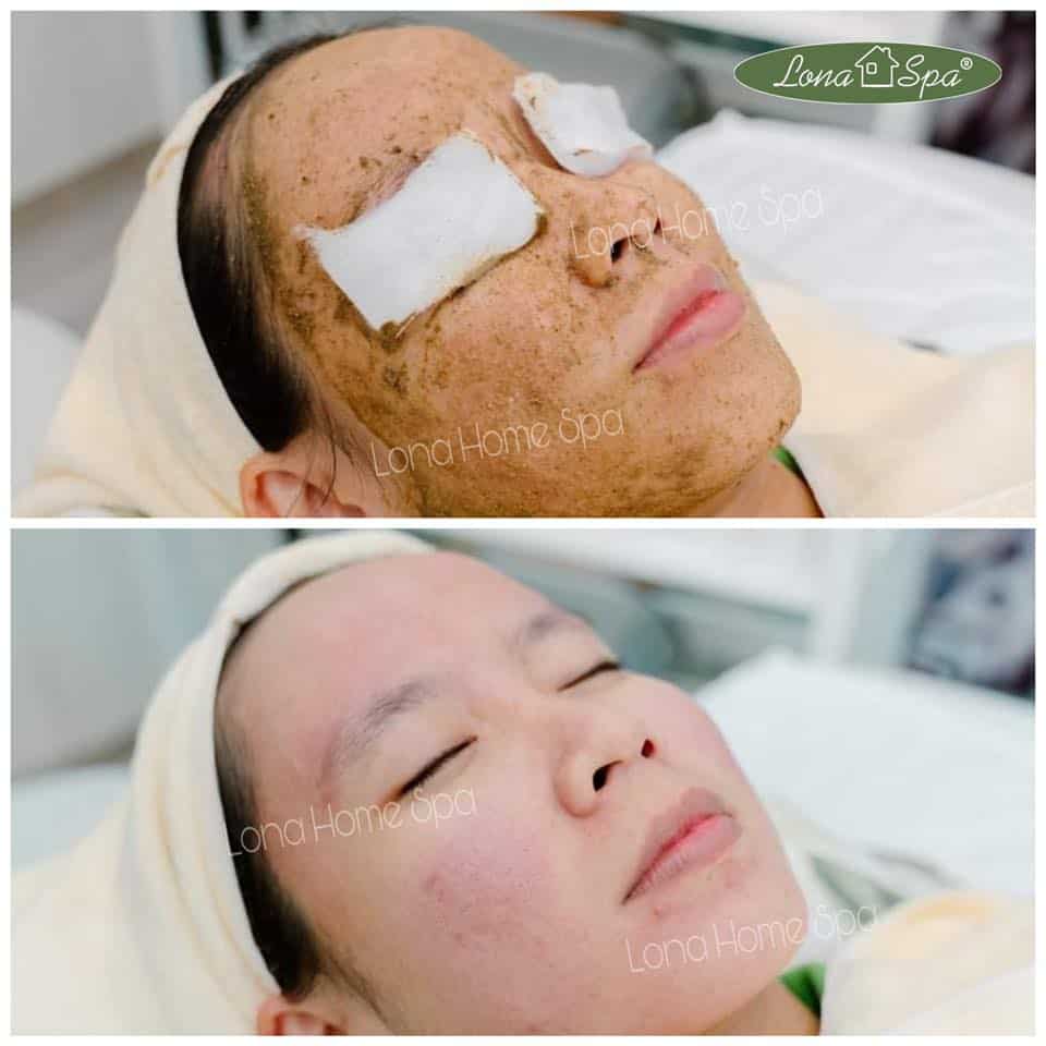 serum chống lão hóa và giảm nếp nhăn 2B Bio