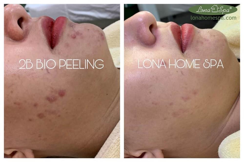serum chứa collagen