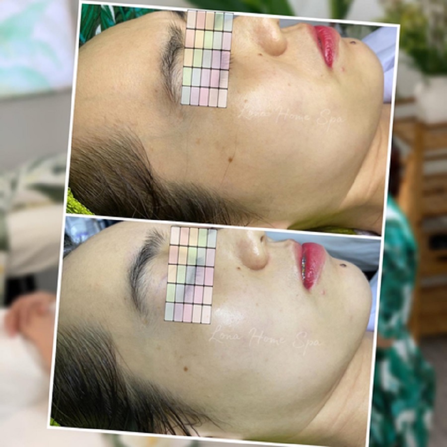 Serum Timeless Hyaluronic Acid