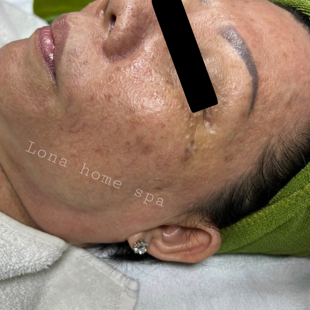 kem dưỡng da chứa retinol