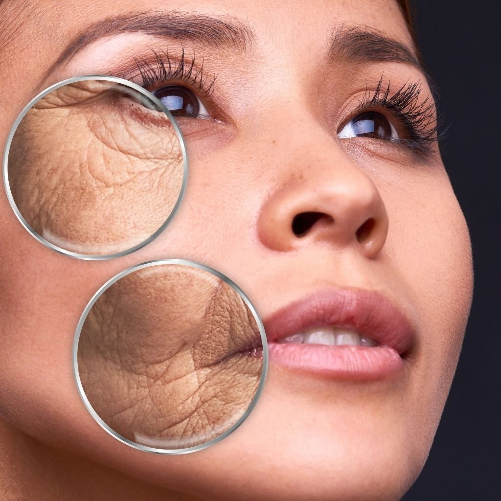 Tretinoin nên kết hợp với gì?