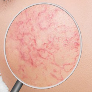 Da Mỏng Yếu và Lộ Mạch