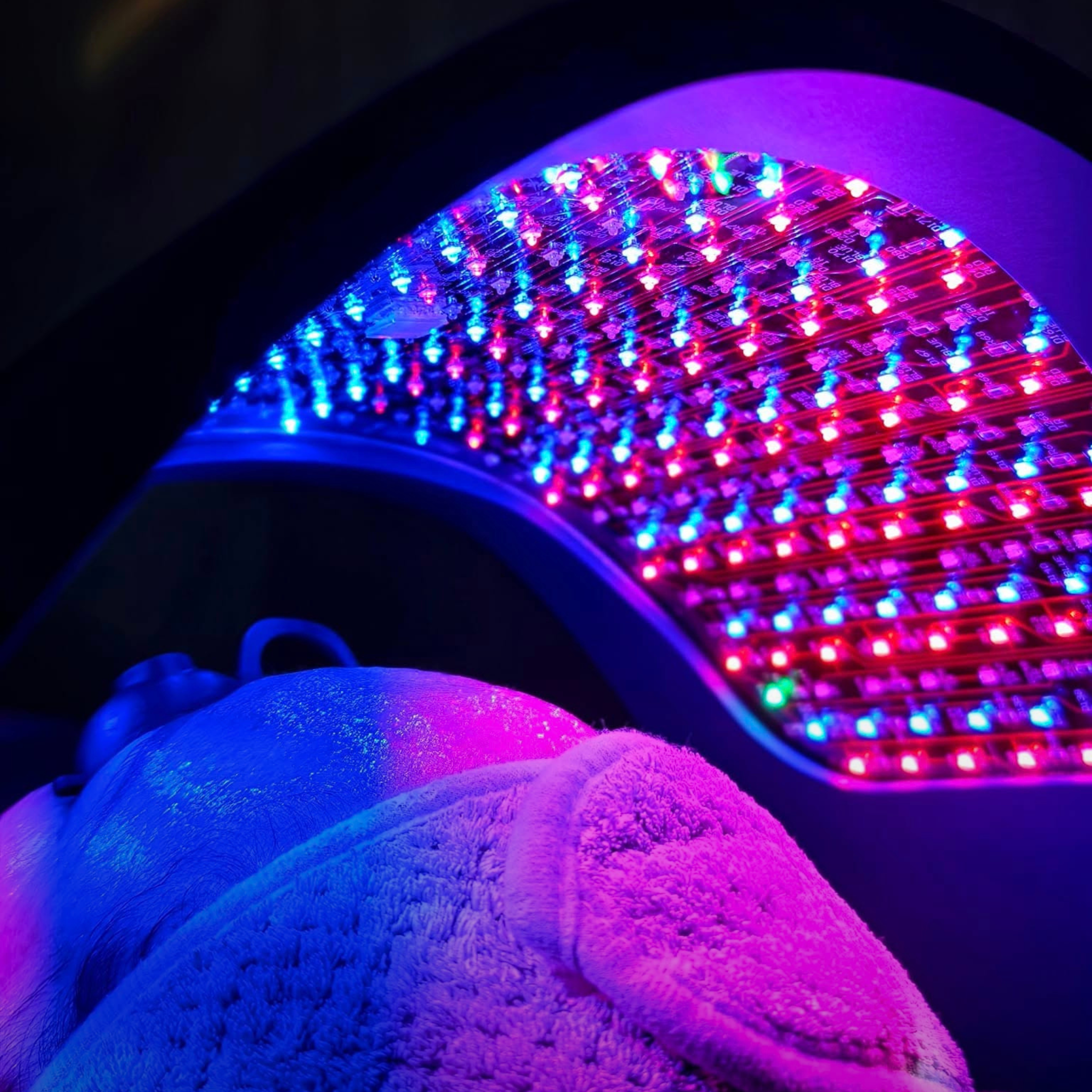 Liệu pháp chiếu đèn Celluma