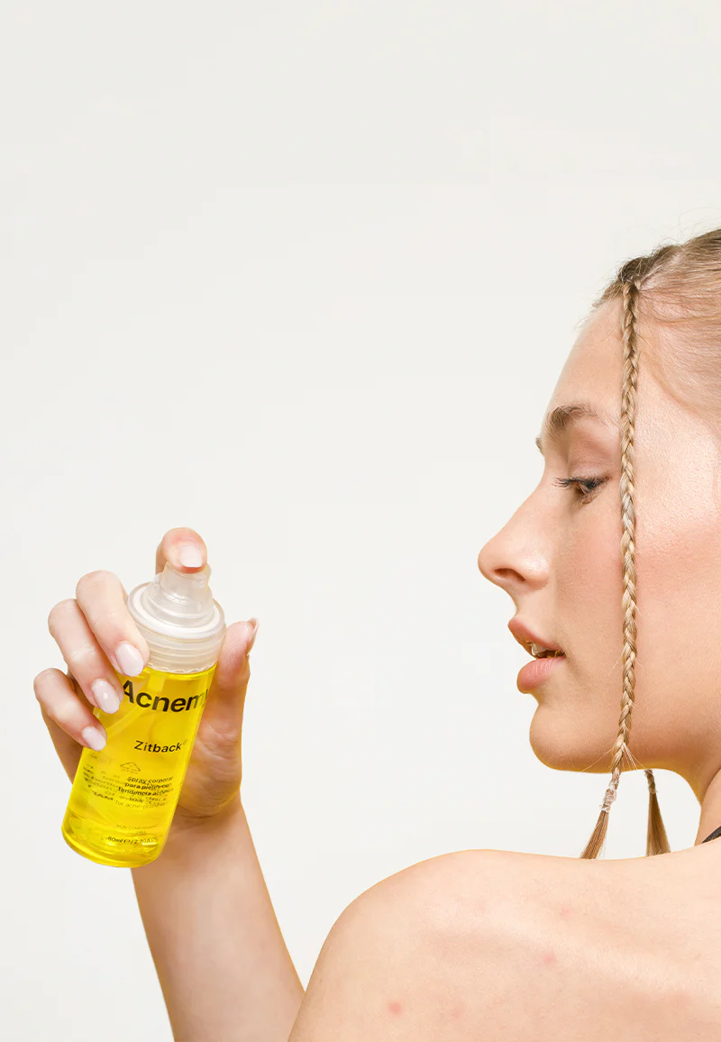 niacinamide hỗ trợ giảm mụn
