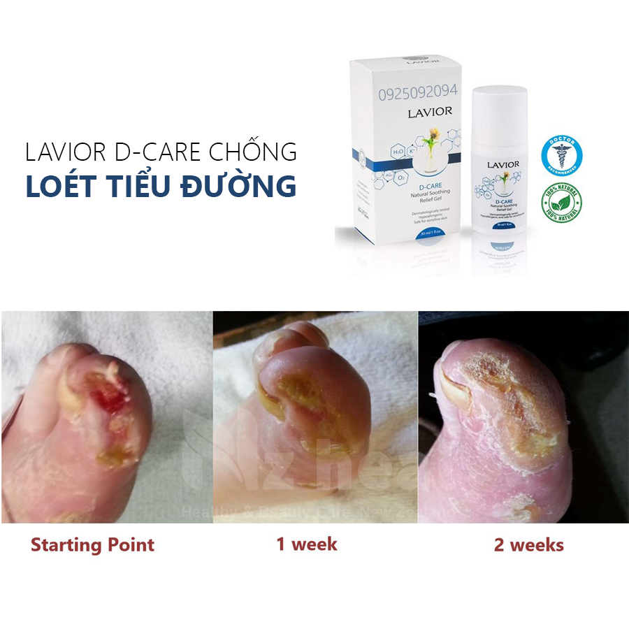 LAVIOR D-CARE có hiệu quả không?