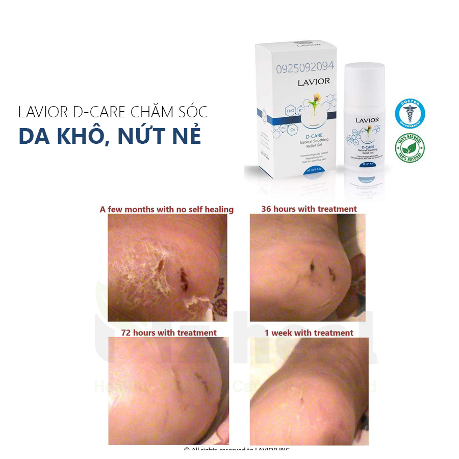 LAVIOR D-CARE làm lành, dưỡng ẩm da khô nứt nẻ
