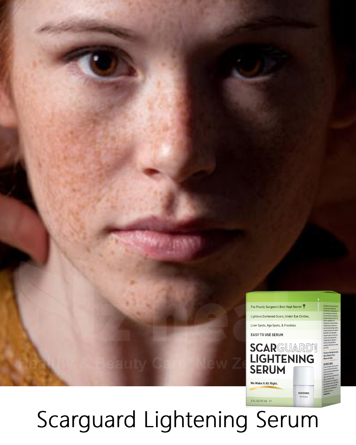 Scarguard Lightening Serum trị tàn nhang