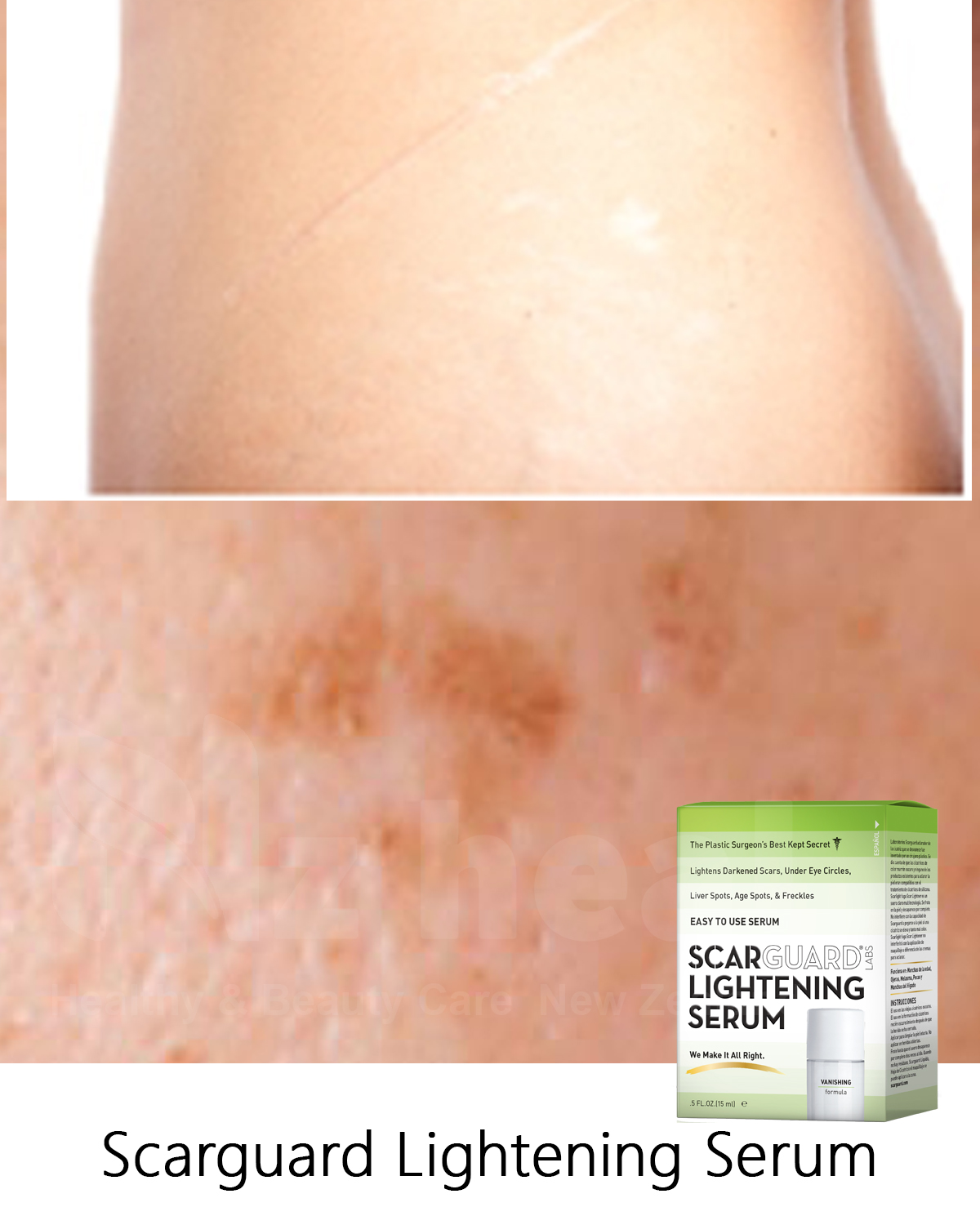 Scarguard Lightening Serum trị sẹo thâm đổi màu