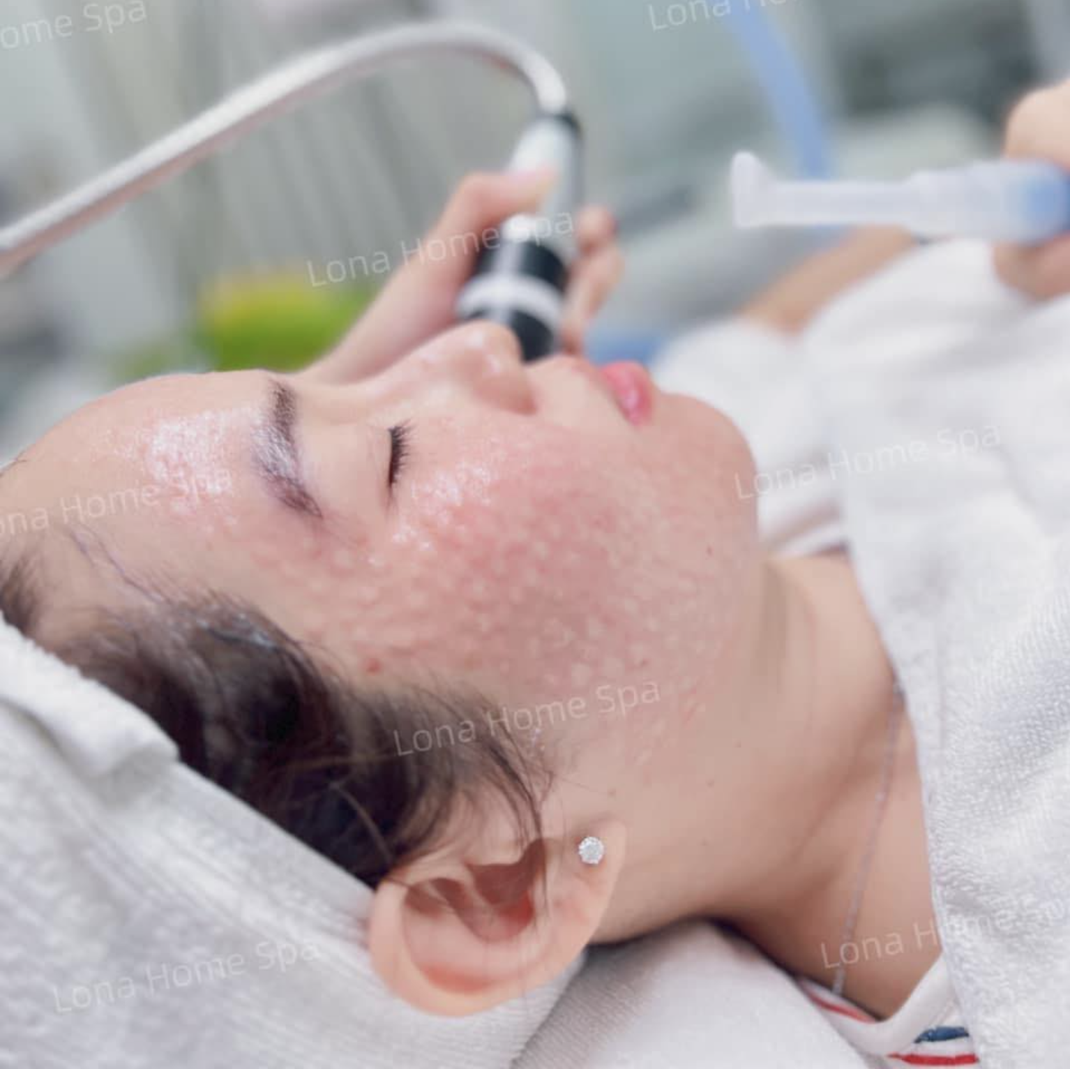 Infini Premium Meso Eyebooster 2x1ml được tiêm theo phương pháp mesotherapy hiện đại, tối ưu hóa việc phục hồi độ ẩm và kích thích collagen cho vùng da mắt.