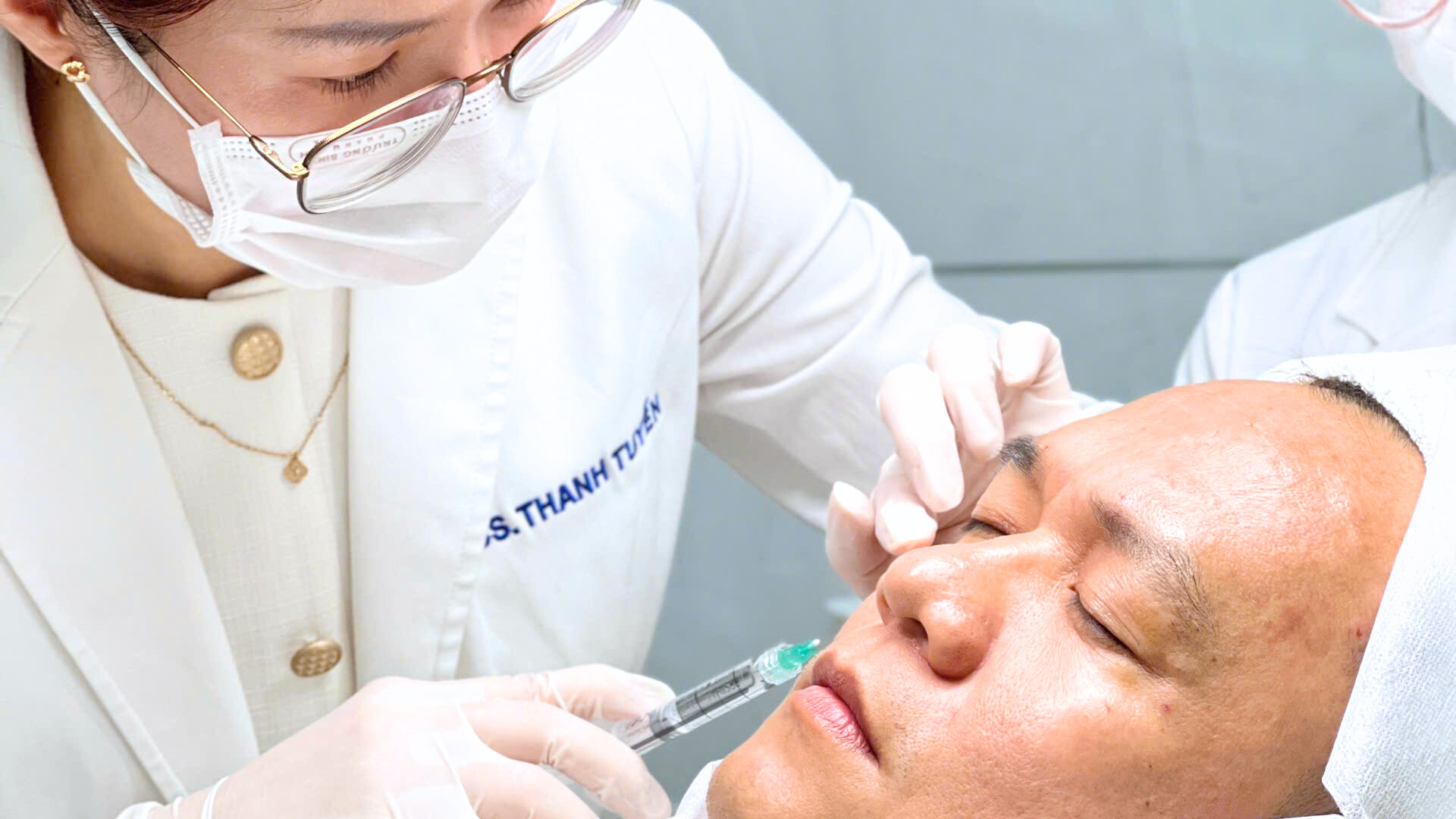 Hình ảnh này minh họa quy trình tiêm filler với SkinFill Gold Plus, thể hiện sự chính xác và tinh tế trong quá trình tái tạo thể tích khuôn mặt theo tiêu chuẩn da liễu hiện đại.