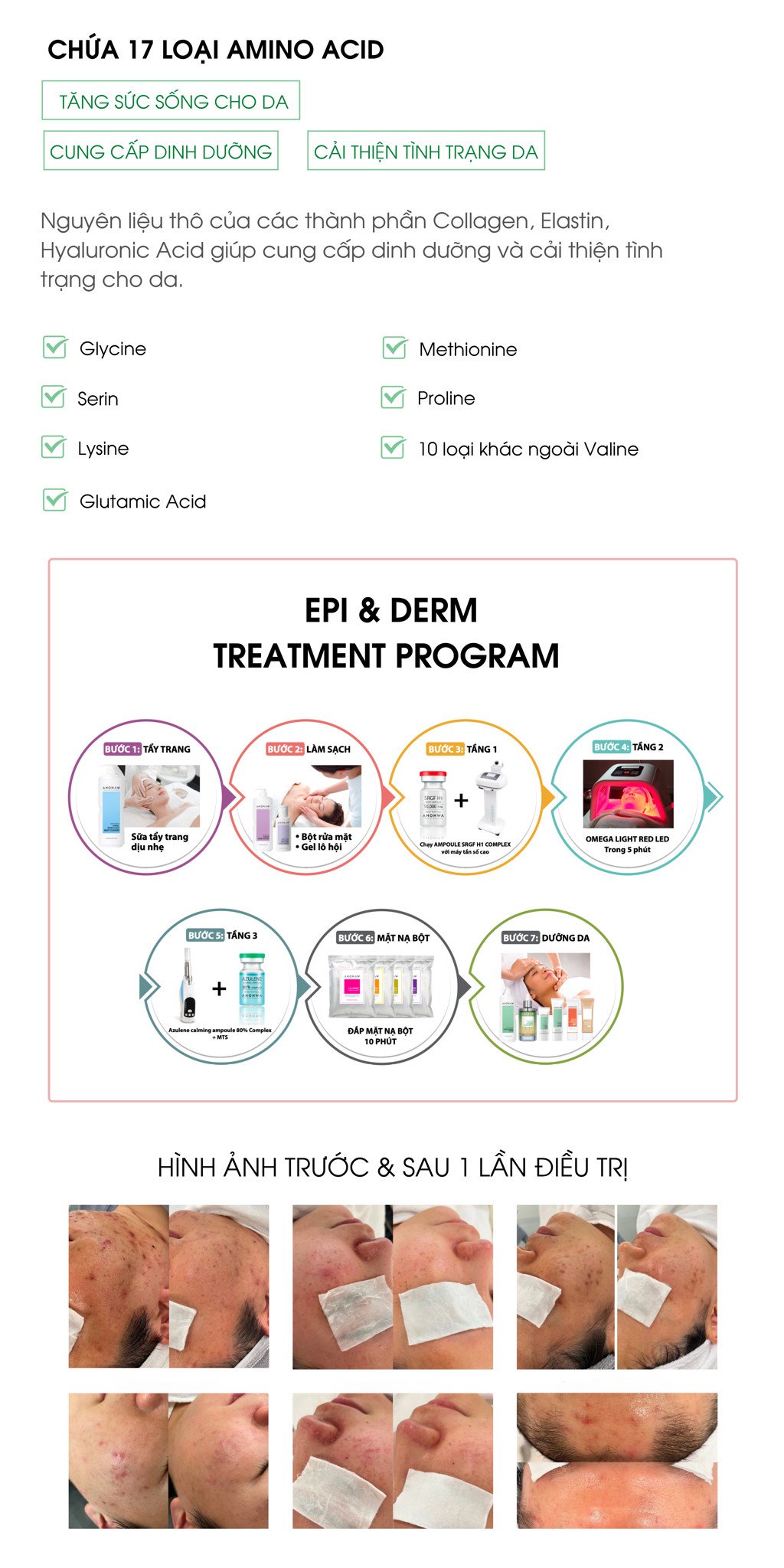 Azulene Calming Ampoule - phục hồi sau peel/laser