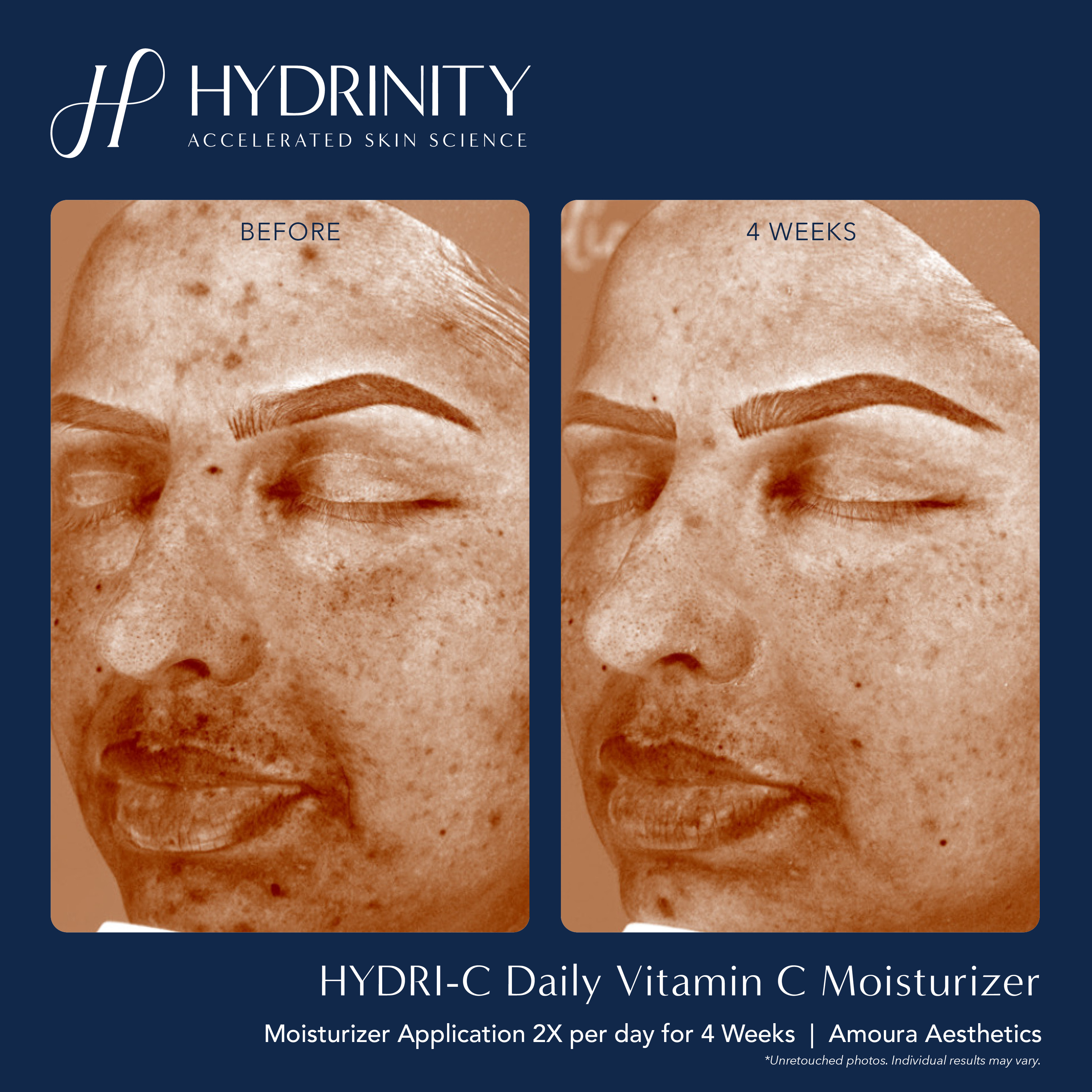 Hydrinity HYDRI-C - kem dưỡng vitamin C cho da nhạy cảm - ảnh sản phẩm 2