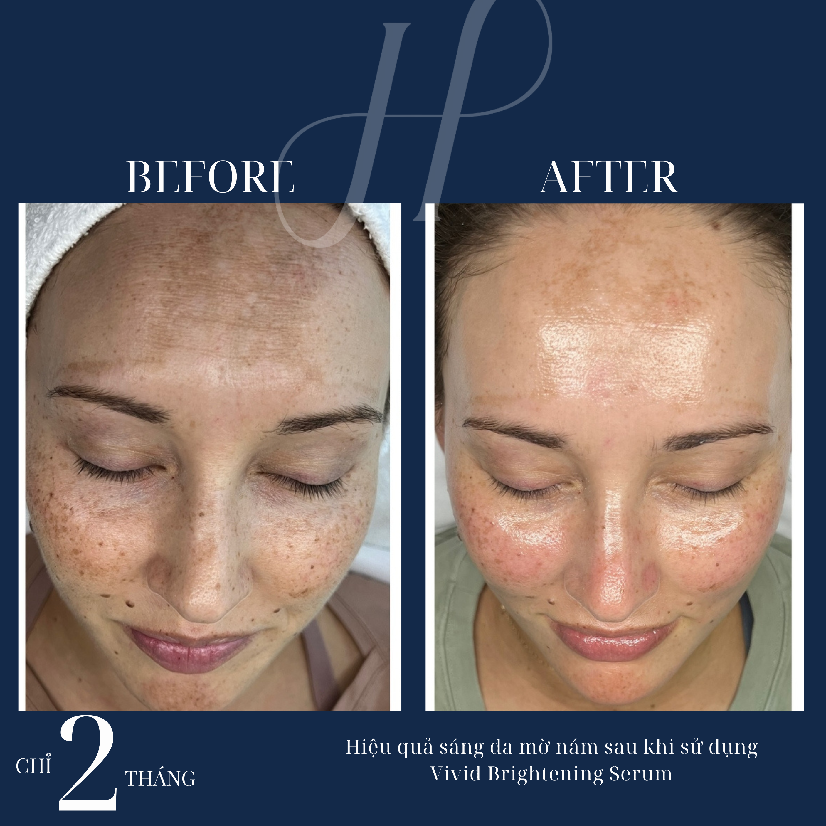 Hydrinity Vivid Brightening Serum - thành phần chính