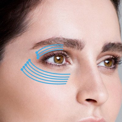 hyaluronic acid chống lão hóa và giảm nếp nhăn