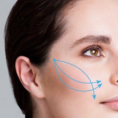 chỉ nâng cơ Visage