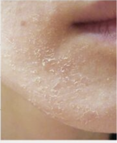 Chăm Sóc Da: Làm Sao Để Da Bạn Luôn Mịn Màng?