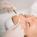 Radiance Beauva Pro Peel 4