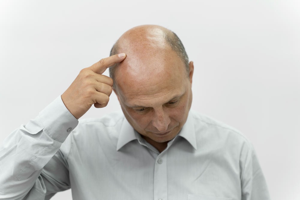 alopecia là gì. Thanh niên mặc áo xanh ôm đầu, cúi người về phía trước, vẻ mặt căng thẳng, nhìn chính diện.