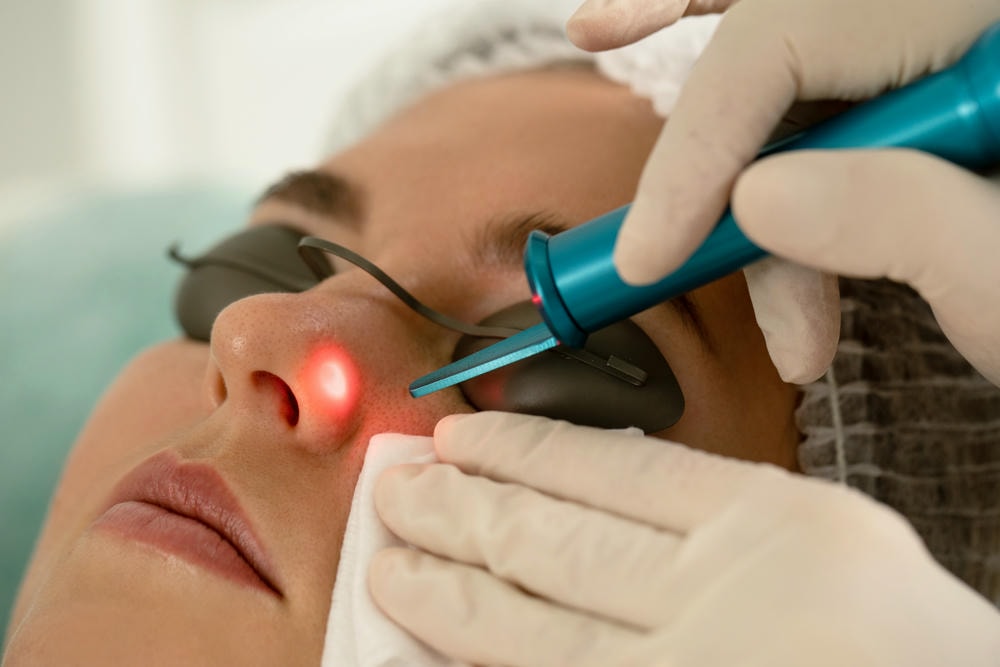Hình ảnh chụp cận cảnh trong khi thực hiện tẩy nốt ruồi bằng laser cho thấy giá tẩy nốt ruồi bằng laser được đưa ra dựa trên chi phí tẩy nốt ruồi minh bạch, đảm bảo phương pháp tẩy nốt ruồi an toàn và cho hiệu quả tẩy nốt ruồi ấn tượng.