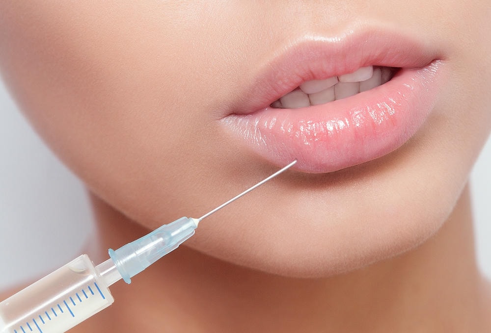 các dáng môi tiêm filler. Người phụ nữ trẻ hấp dẫn được tiêm thẩm mỹ