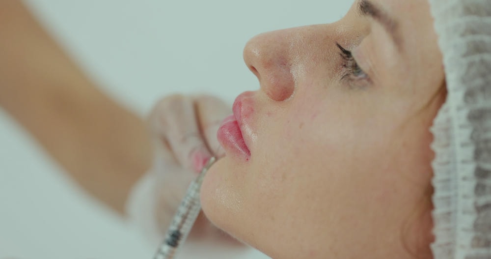 Với sự phân tích dáng môi tỉ mỉ, các dáng môi được đánh giá để đưa ra lựa chọn filler phù hợp, qua đó thực hiện tiêm filler môi bằng các loại filler chất lượng, thể hiện rõ bàn tay điêu luyện trong việc tạo dáng môi.