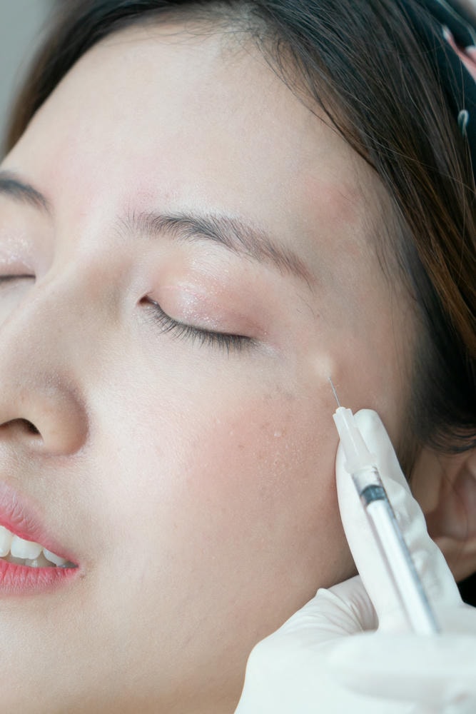 Chuyên gia Lona Skin Lab minh chứng hiệu quả của liệu pháp nâng cơ qua việc so sánh Botox và Filler, trong đó Botox và Filler được sử dụng song song để đảm bảo nâng cơ tối ưu.