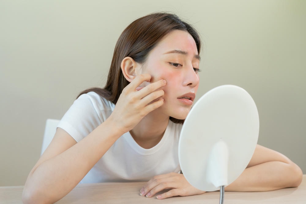 Bức ảnh minh họa cách chăm sóc da mụn với sự nhạy bén khi chăm sóc da mụn ở đối tượng da tuổi dậy thì, kết hợp quy trình chăm sóc da mụn hiện đại và cách trị mụn hiệu quả, theo chỉ dẫn của chuyên gia da liễu Lona, đồng thời khuyến khích dưỡng da mụn tự nhiên.