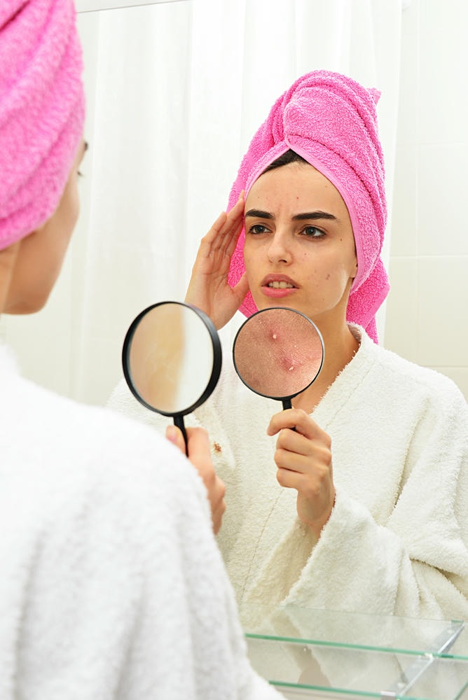 cách để hết mụn <a href=