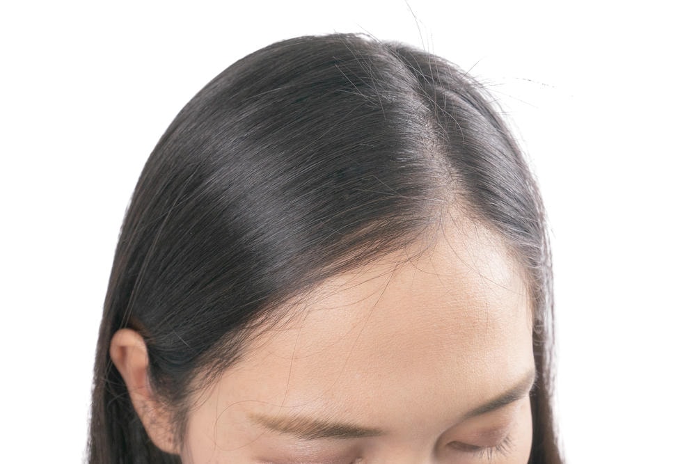 cách giúp tóc mọc nhanh. Phụ nữ trẻ Châu Á lo lắng về các vấn đề như rụng tóc, hói đầu, gàu.