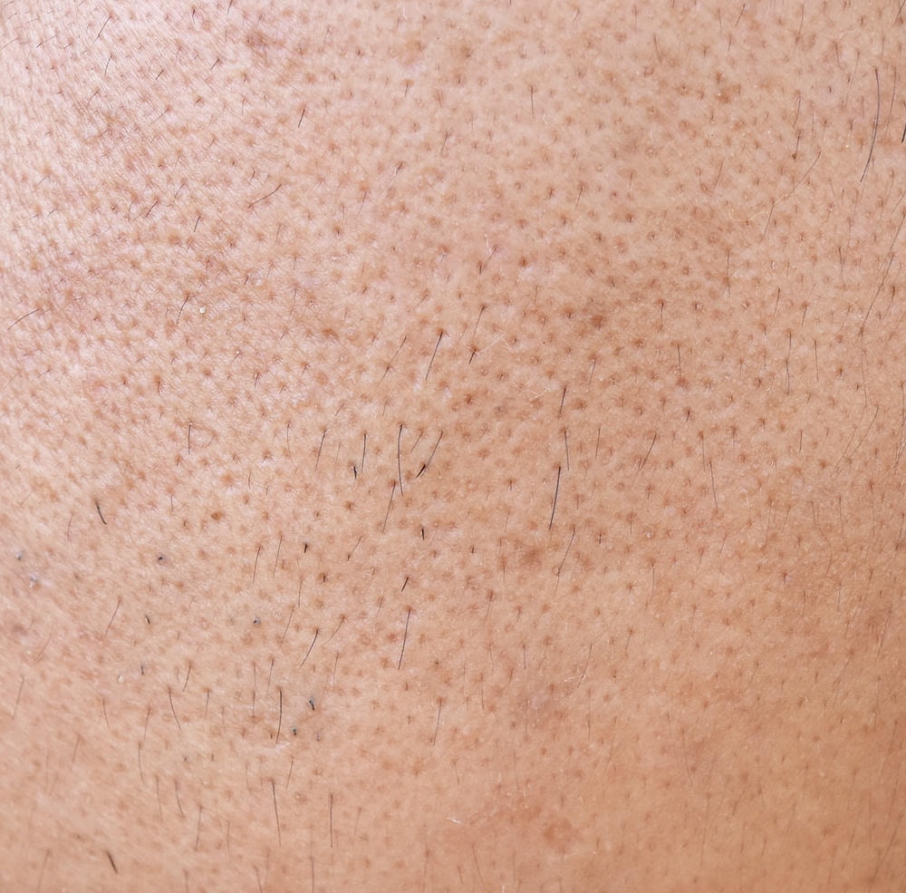 Phương pháp cách thu nhỏ lỗ chân lông và cách làm nhỏ lỗ chân lông, cùng với thu nhỏ lỗ chân lông và se khít lỗ chân lông, góp phần chăm sóc da mặt theo tiêu chuẩn của Lona Skin Lab.