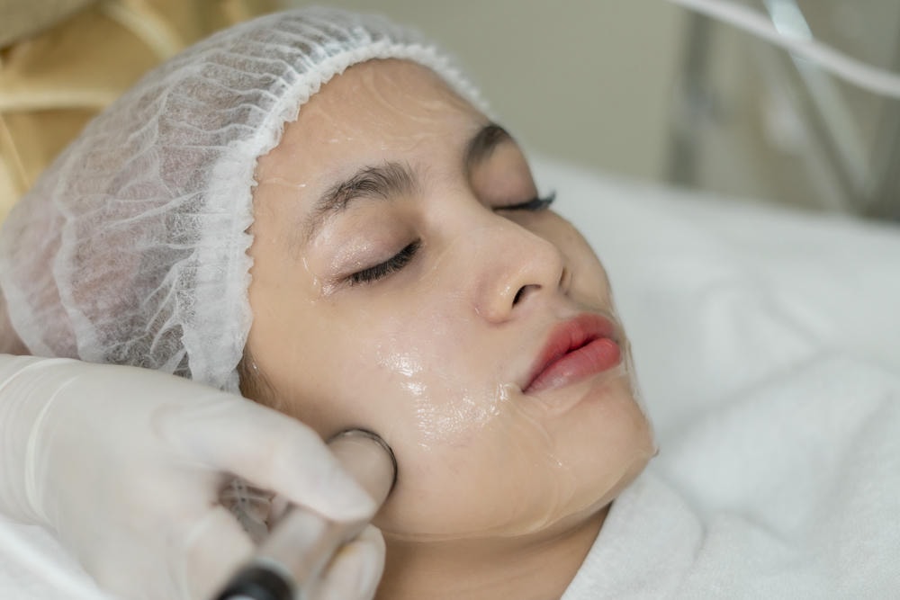 Kết hợp giữa công nghệ nano collagen, collagen nano và Collagen Nano, cùng với quy trình căng chỉ collagen tiên tiến của Lona Skin Lab, phương pháp này đã trở thành giải pháp trẻ hóa da được ưa chuộng trong ngành da liễu.
