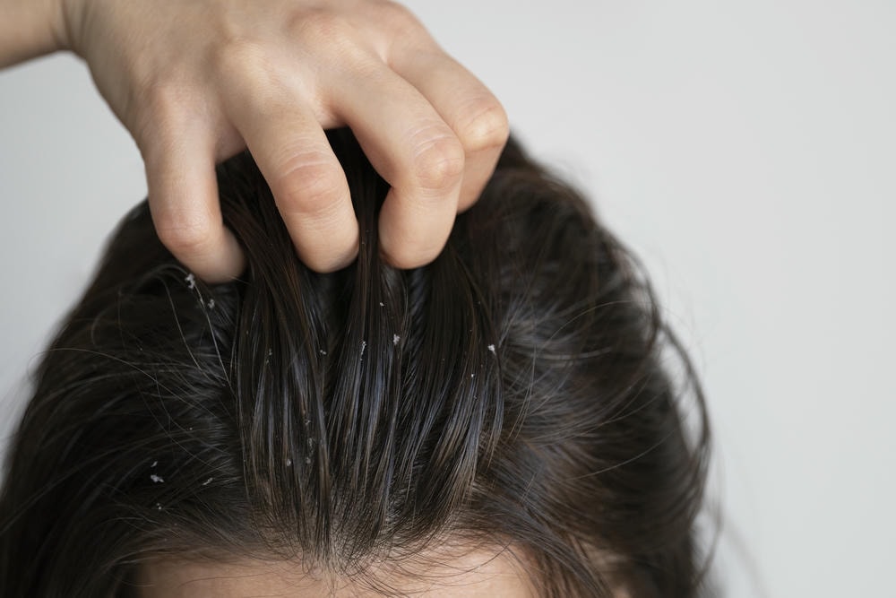Dựa trên kinh nghiệm chuyên môn, dầu gội trị gàu tốt nhất được chứng nhận là dầu gội trị gàu hiệu quả khi kết hợp với dầu gội trị gàu an toàn, là lựa chọn hàng đầu mà dầu gội trị gàu chuyên gia khuyên dùng cho những trường hợp da đầu nhạy cảm.