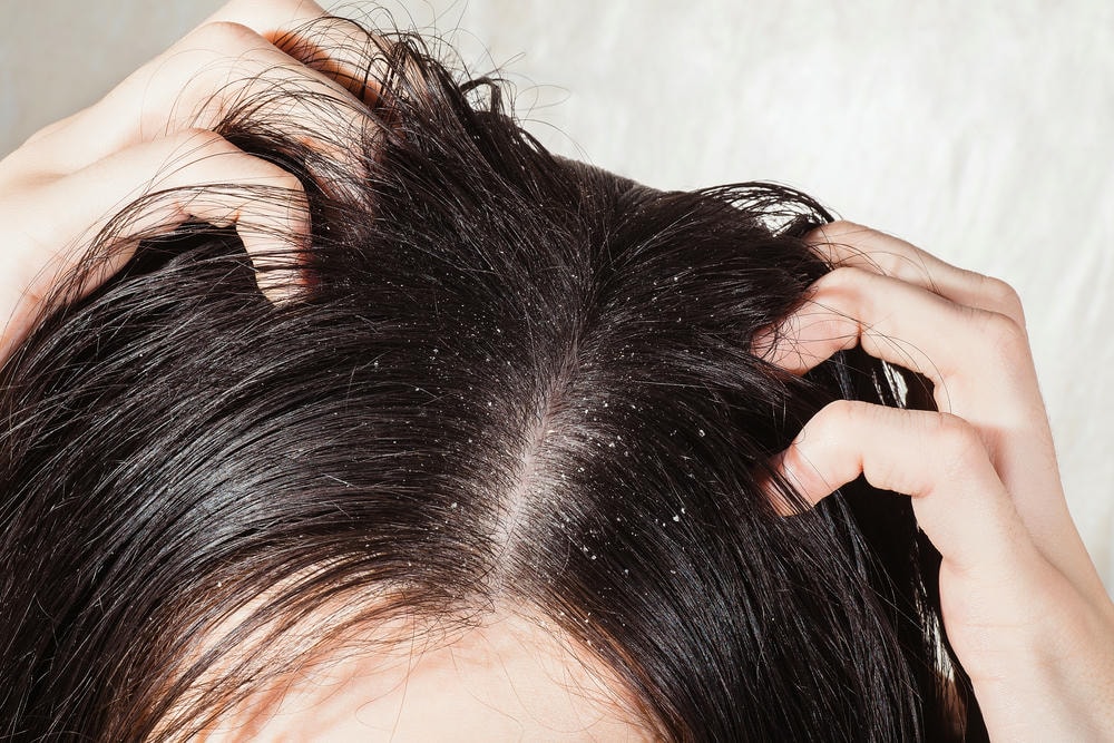 Qua các phân tích của chuyên gia da liễu, dầu gội trị gàu được chứng minh là dầu gội trị gàu hiệu quả và dầu gội trị gàu an toàn; sản phẩm này thực sự là dầu gội trị gàu tốt nhất khi điều trị triệu chứng gàu bằng cách cân bằng da đầu.
