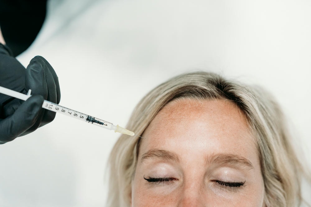 Hình ảnh chuyên sâu về filler teoxane và Filler Teoxane, thể hiện quy trình tiêm với Công nghệ RHA của Teoxane, minh chứng đáp án Filler Teoxane là gì, Ưu điểm của Filler Teoxane và Hiệu quả của Filler Teoxane.
