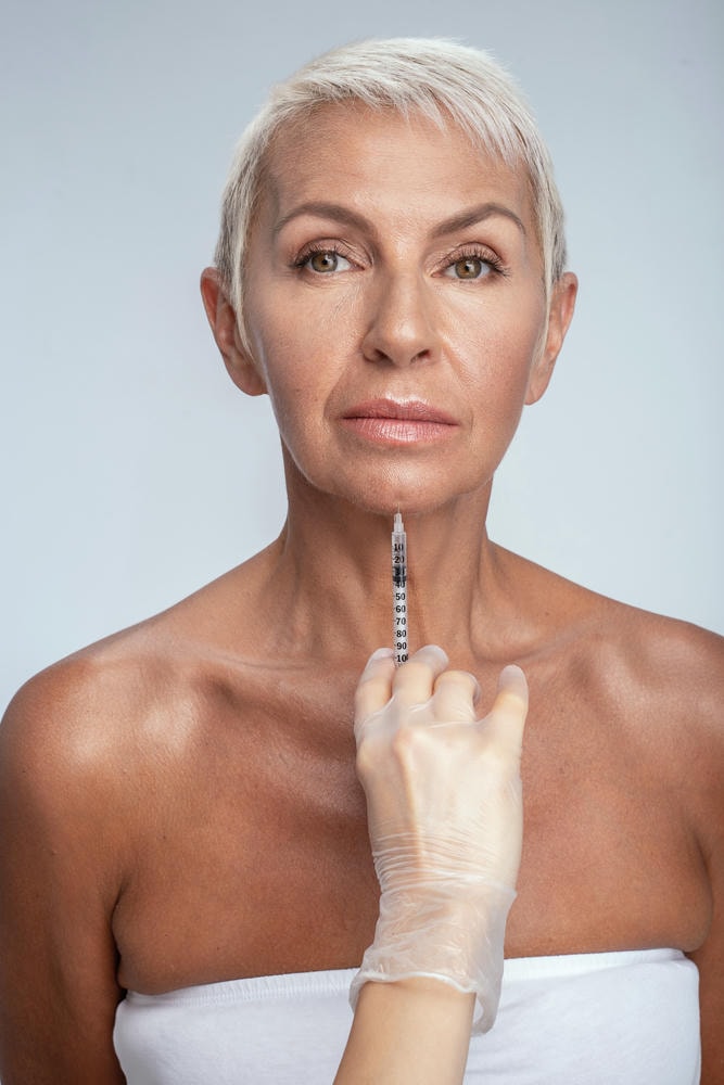 Hình chụp Filler Teoxane thể hiện tính tự nhiên của filler teoxane, giúp làm nổi bật Công nghệ RHA của Teoxane và giải thích Filler Teoxane là gì, đồng thời khẳng định Ưu điểm của Filler Teoxane và Hiệu quả của Filler Teoxane trong điều trị.