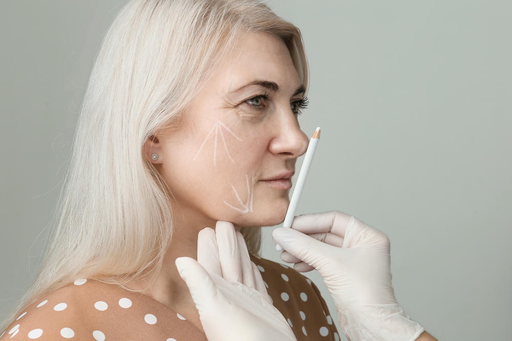 giá filler. Người làm đẹp đánh dấu trên khuôn mặt người phụ nữ bằng bút chì trắng
