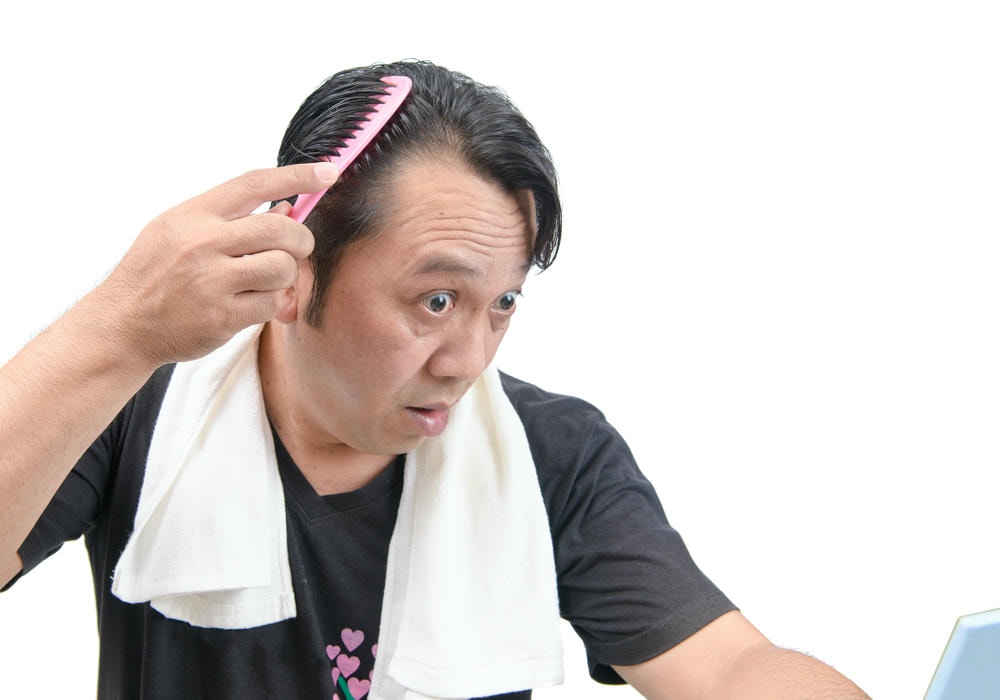 giảm rụng tóc. Một người đàn ông châu Á lo lắng về rụng tóc hoặc hói đầu bị cô lập