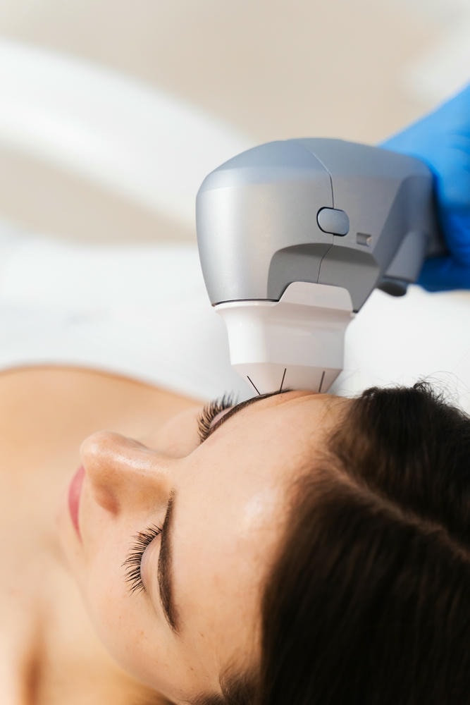 Công nghệ HIFU được thể hiện qua bức ảnh nhằm nâng cơ và căng da mặt, đóng góp vào nỗ lực cải thiện da lão hóa và hỗ trợ so sánh HIFU và Thermage trong liệu trình điều trị.