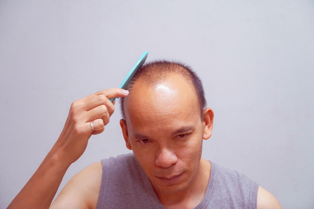 hói tóc. Cận cảnh người đàn ông chải tóc trên nền xám