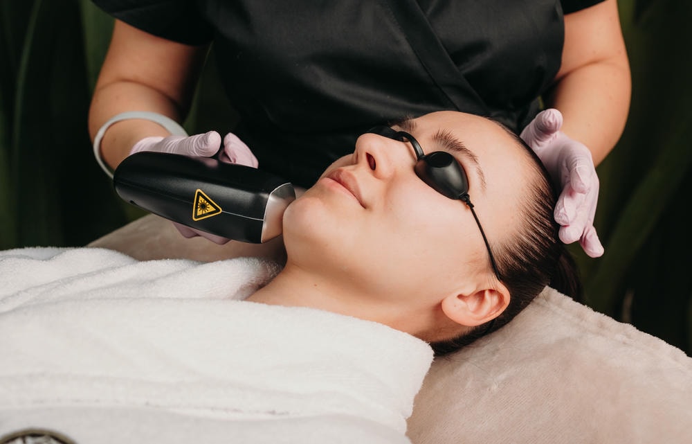 Hình ảnh thể hiện việc áp dụng công nghệ IPL qua quy trình điều trị mụn bằng IPL, nhấn mạnh vai trò của IPL trị mụn trong việc tối ưu hóa kết quả điều trị da. 