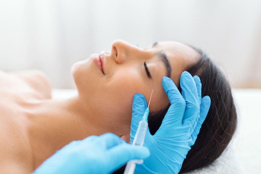 Hình ảnh thể hiện rõ tình trạng tiêm filler với Juvederm, trong đó juvederm được lựa chọn làm chất làm đầy da lý tưởng cùng với filler Juvederm và quy trình tiêm filler do chuyên gia da liễu thẩm mỹ Lona giám sát.