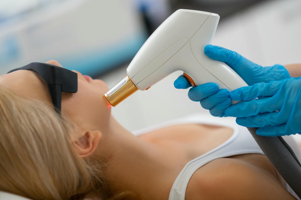 Hình ảnh laser Q-Switched này cho thấy quy trình laser điều trị da tiên tiến, nơi chuyên gia da liễu thẩm mỹ Lona vận dụng laser, laser CO2, laser Er:YAG và laser Q-Switched nhằm đạt hiệu quả điều trị xuất sắc.