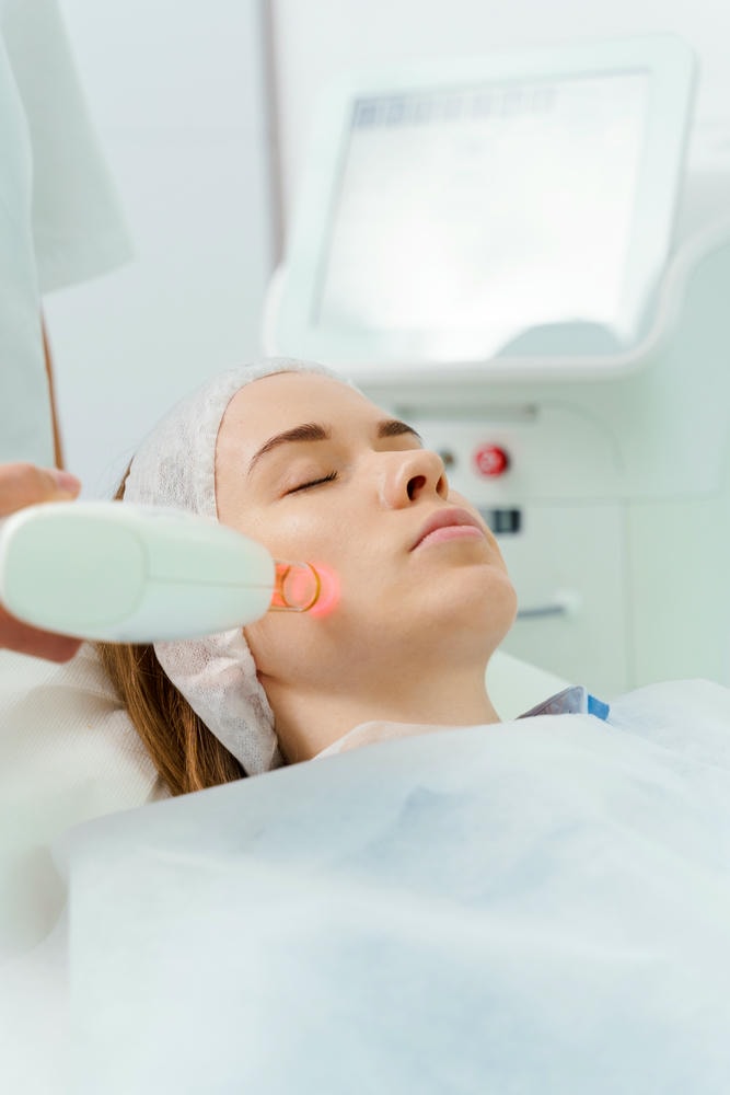 Hình minh họa về điều trị da đỏ qua laser, thể hiện tăng sinh mạch máu là gì và tình trạng da đỏ do tăng sinh mạch máu, qua đó trình bày phương pháp điều trị da đỏ tiên tiến giảm thiểu nám má tăng sinh mạch máu.