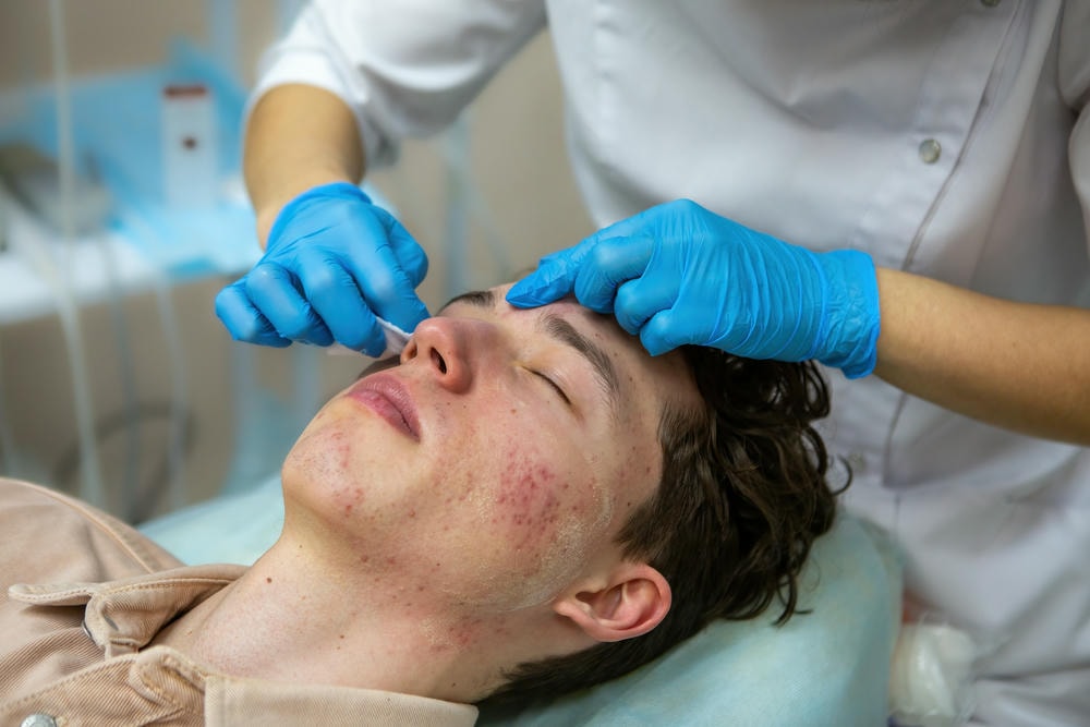 Quy trình lấy nhân mụn chuẩn y khoa được thực hiện bởi chuyên gia da liễu, kết hợp phương pháp lấy nhân mụn hiện đại để chăm sóc da mụn và nâng cao thẩm mỹ da.