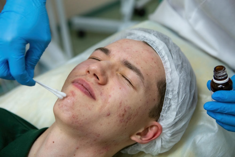 Hình ảnh ghi nhận cách lấy nhân mụn dưới sự chỉ dẫn của chuyên gia Lona Skin Lab, khẳng định phương pháp điều trị mụn hiệu quả và cách trị mụn hiệu quả, đồng thời tạo điều kiện chăm sóc da mụn toàn diện.